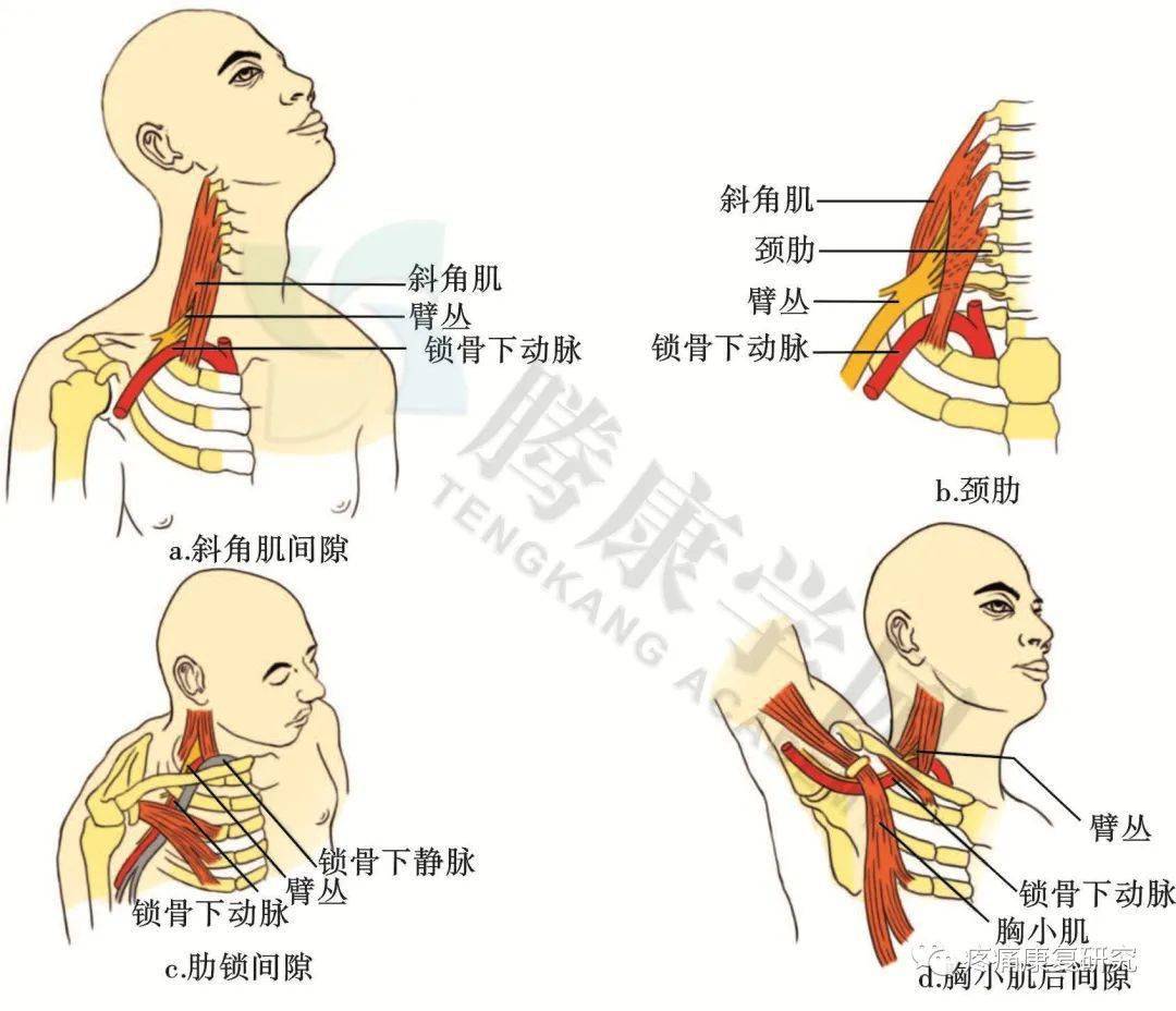 臂丛神经点示意图图片