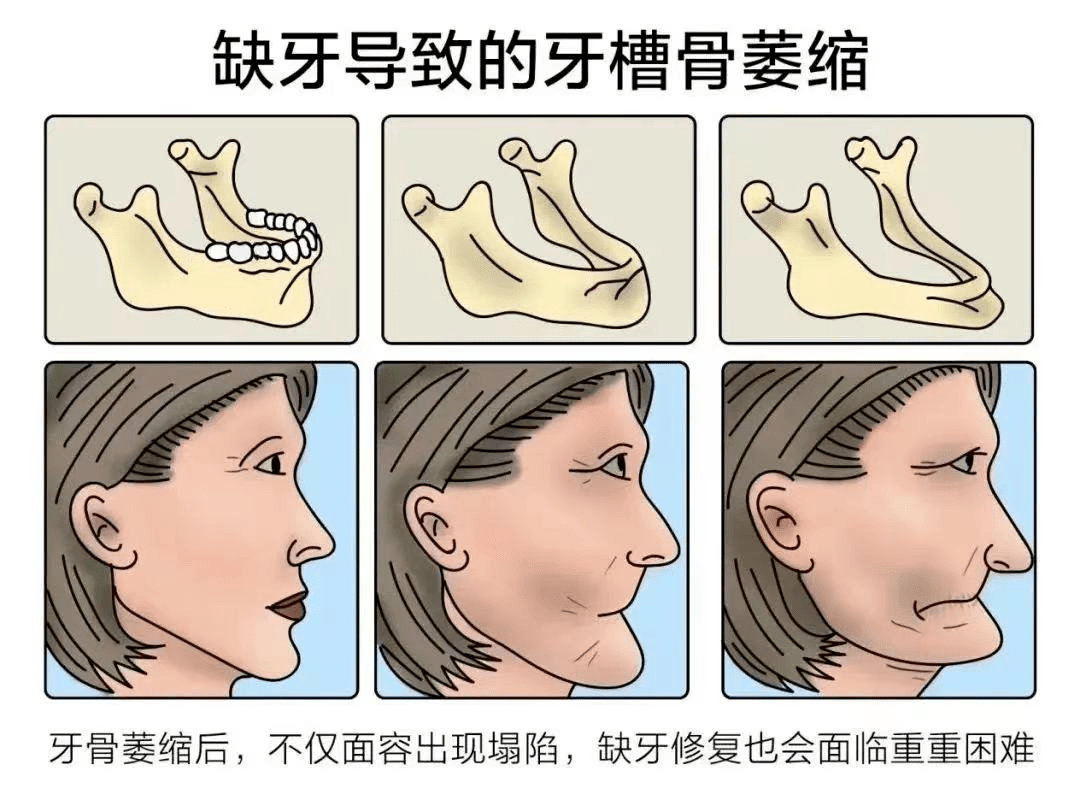 牙齿颊部的位置图片图片