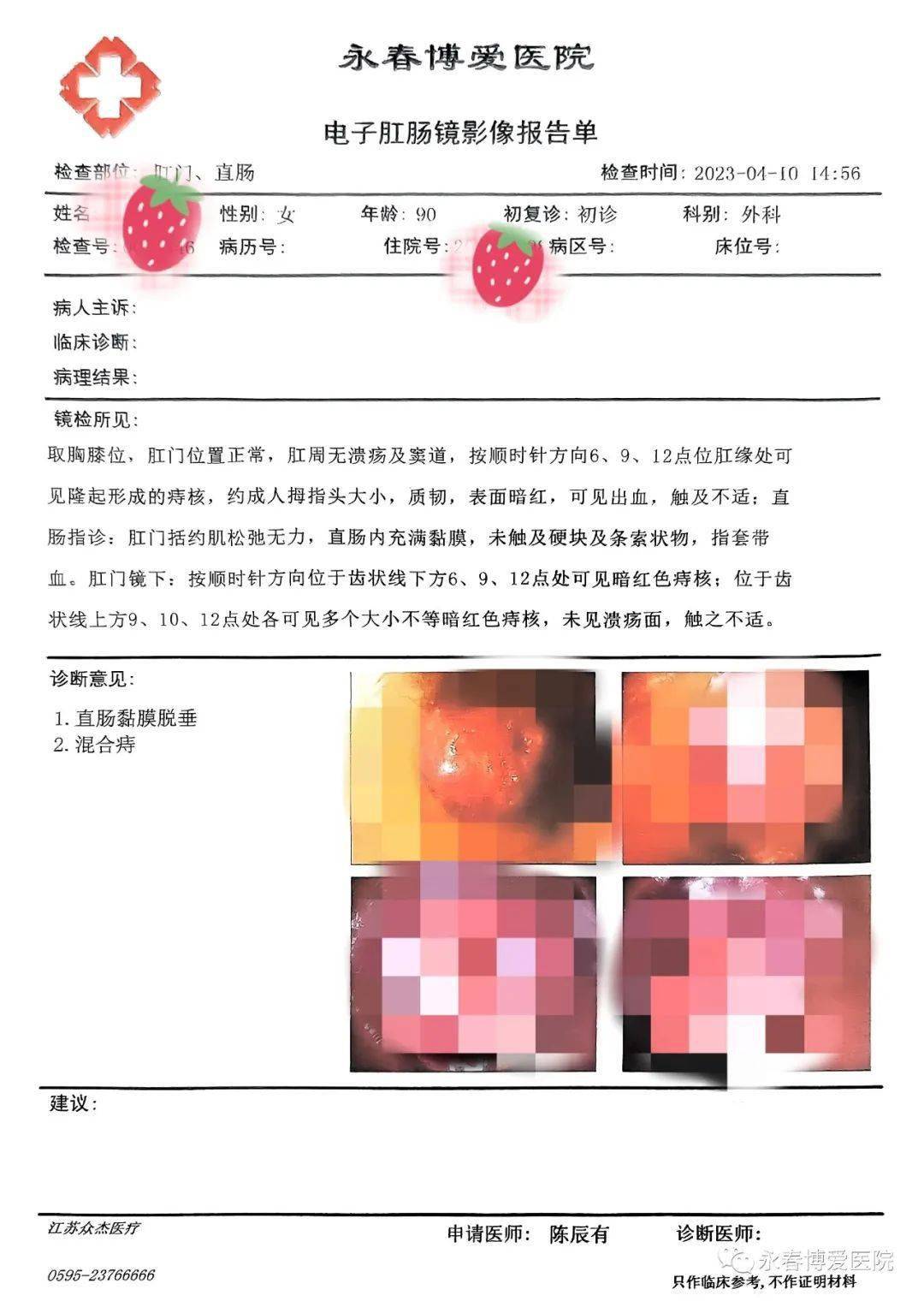 有了初步的判断并安排陈奶奶进行了肛门镜和相关检查确诊为直肠黏膜