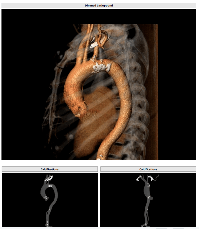 近日,昆明医科大学第一附属医院心内科孟照辉结构性心