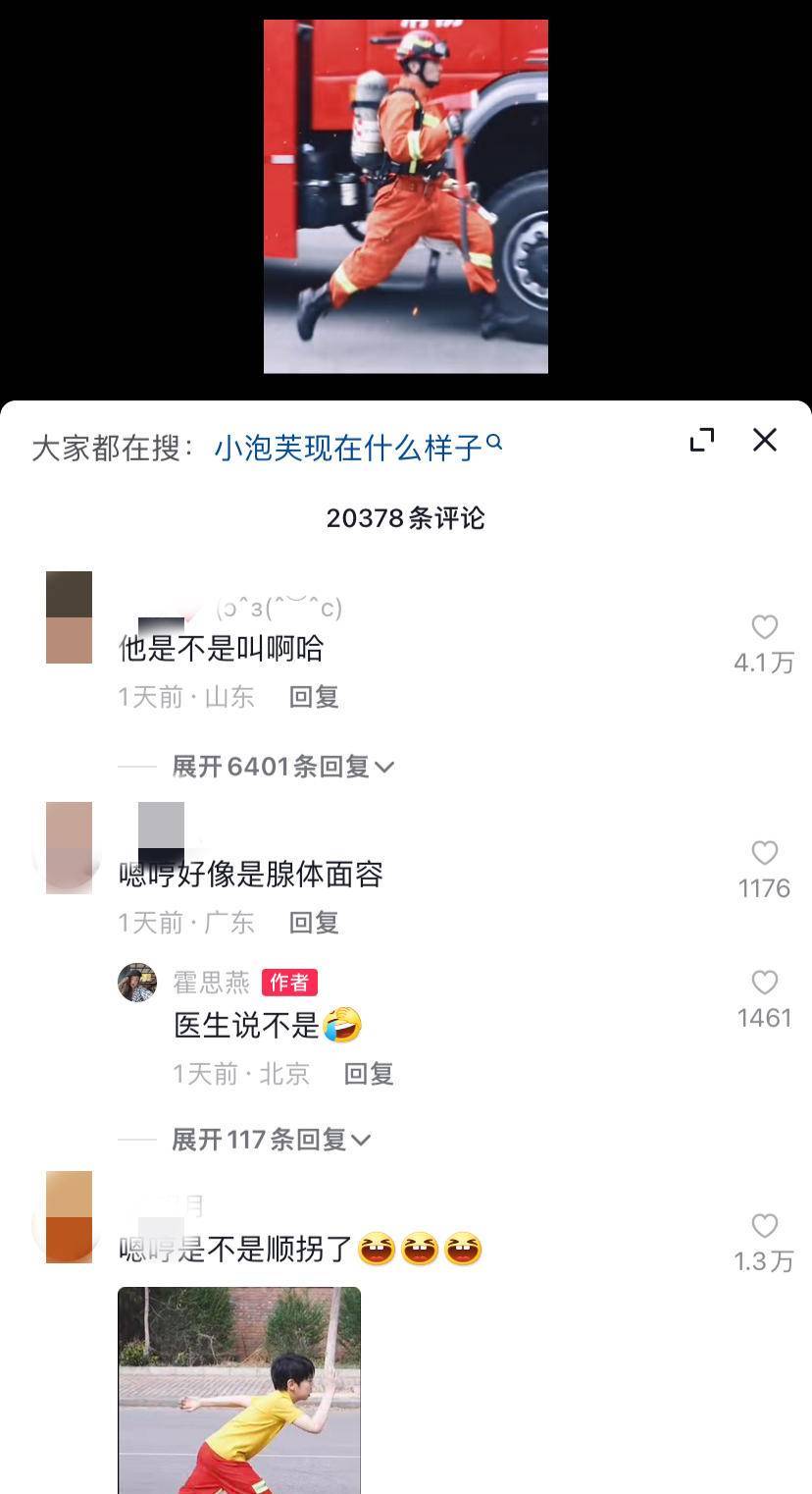 嗯哼疑似腺样体面容引发关注医生提醒：孩子睡觉打鼾需要引起注意