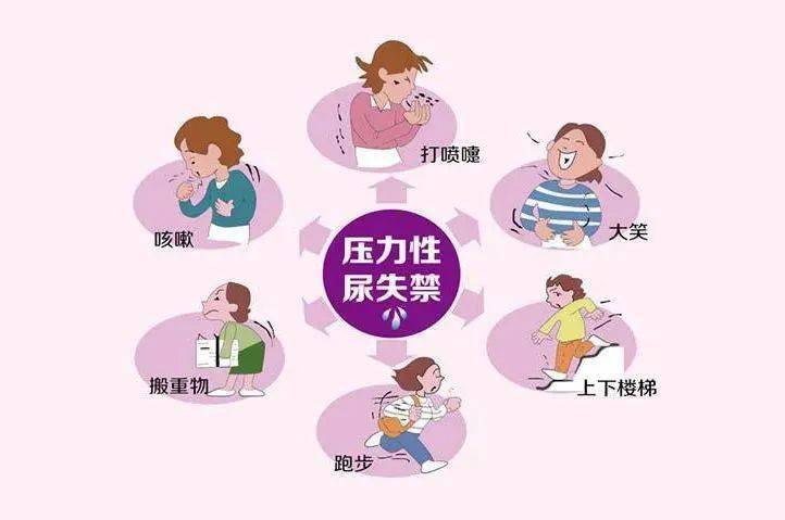 咳嗽,行走就漏尿,一根"吊带"帮60岁的她破解"滴滴答答"的尴尬事儿_刘