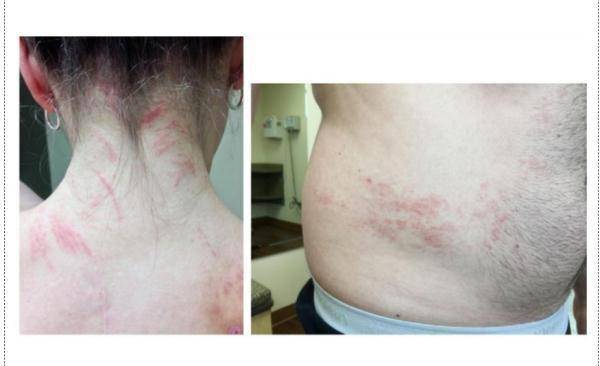 香菇_沈女士_食用