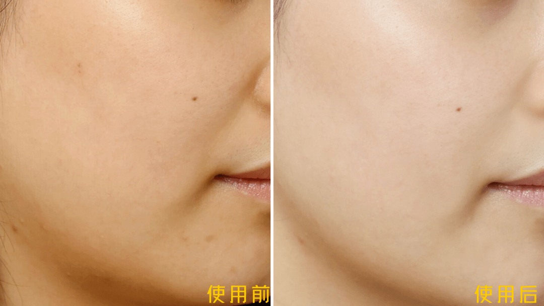 得比较多,所以防晒这块我是一直很用心在做,但耐不住这大油皮出油超多