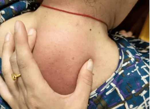 一针去除——富贵包_篇文章_朋友_原则