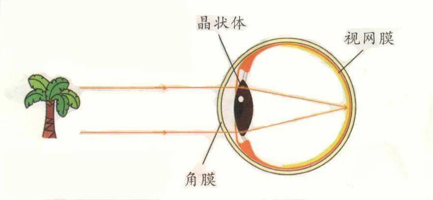 近视眼的成像原理图解图片