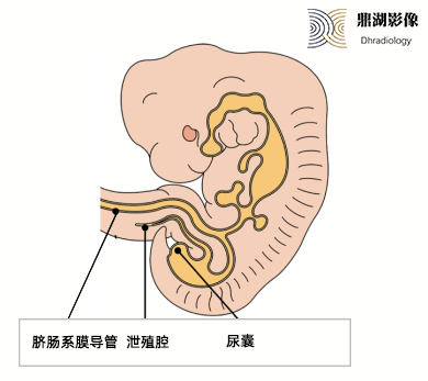 脐尿管位置图详细图片