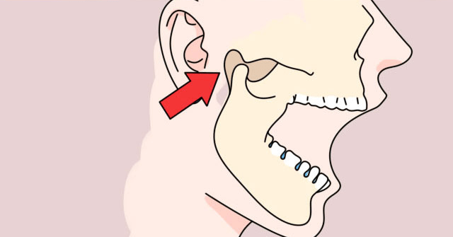 正畸治疗——颞下颌关节运动_口腔_功能_平台