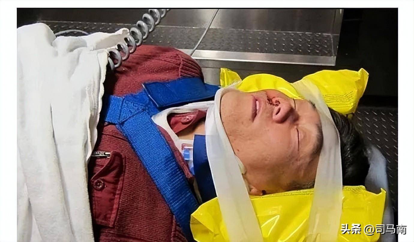 司马南:电梯可能夹头,也可能要命!