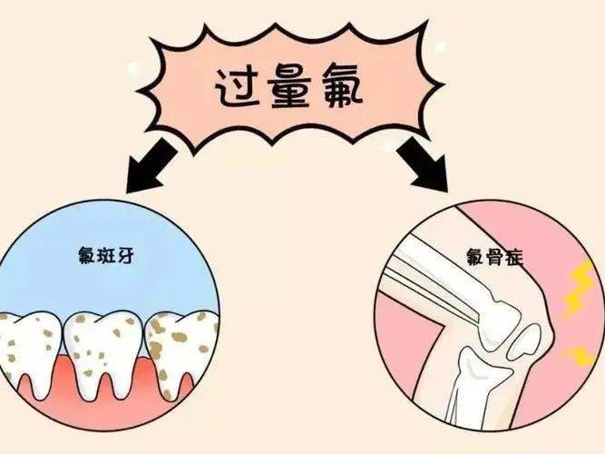 【健康济宁行动】健康科普丨饮水型地方性氟中毒小知识