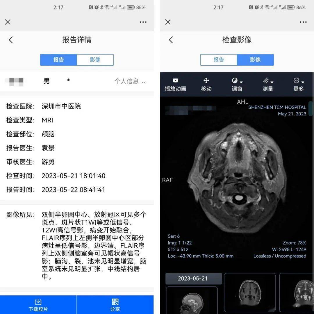 市中医院"云胶片"上线,看病再不用提着大袋胶片啦!_报告_影像_服务