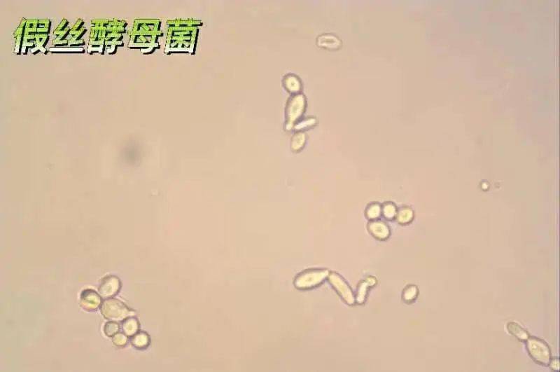 加德纳菌的典型图片图片