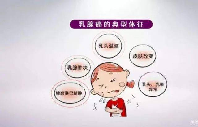 妇幼科普 乳腺癌科普知识