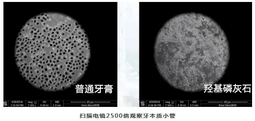 这支获奖无数的牙膏,竟能让牙齿再生,牙黄牙垢唰唰落,烂牙变好牙!