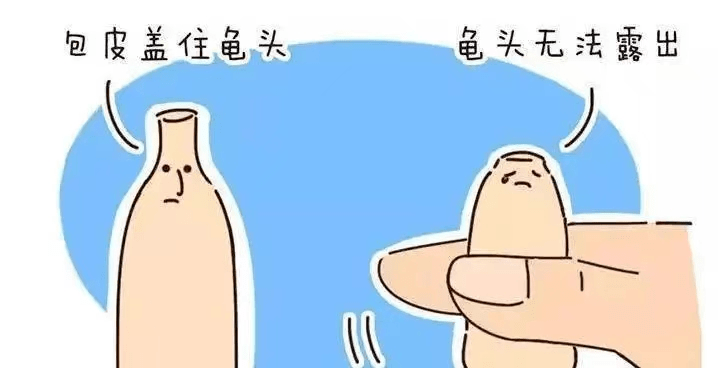 但可以被轻松翻起露出冠状沟