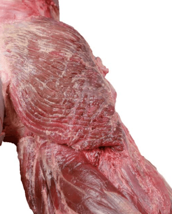 从大体标本的臀大肌下面观,可以看到臀大肌下部肌束包被坐骨结节(图6