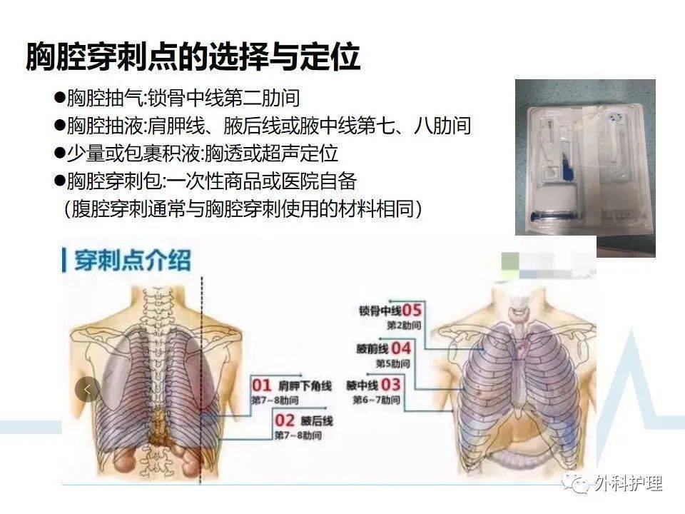 胸腔穿刺点定位图图片