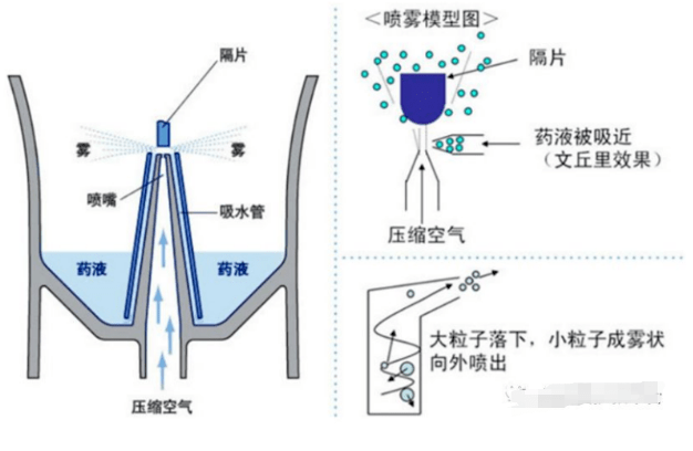 雾化吸入治疗经常做,而这些“雾区”里的“误区”,很多护士不知道_患者_药物_效果