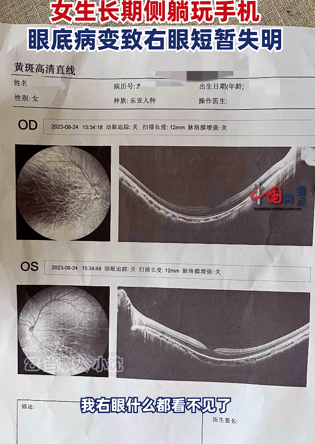 女子长期侧躺玩手机致右眼短暂失明 侧躺玩手机对哪只眼睛伤害大