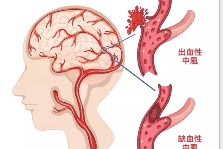 脑血管走行图图片