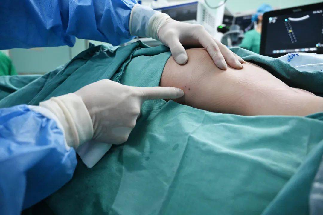 年龄上限放宽到了14岁,这个公益项目扩大了免费救治覆盖面_许可_手术