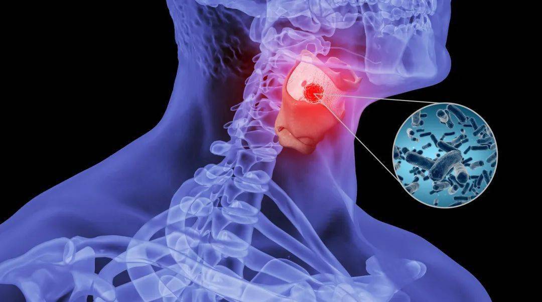 全国各地都在咽喉炎?新冠和甲流同流行?专家提醒!_防控_疫情_风险