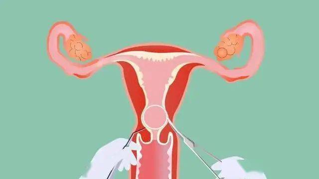 26世界避孕日】科学避孕,让爱与计划同行_方法_女性_月经