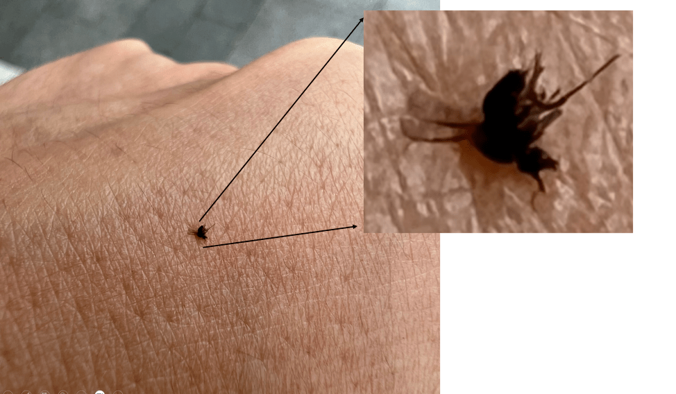 越抓越痒,最近很多人中招!_蠓虫_地方_症状