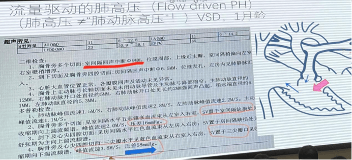 肺高压 ≠ 肺动脉高压!