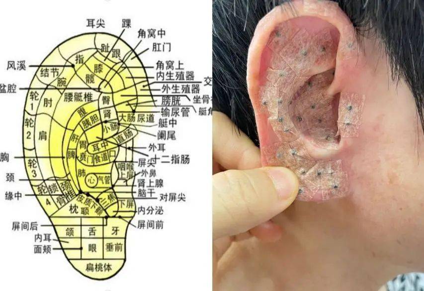 耳朵埋豆位置图简单版图片