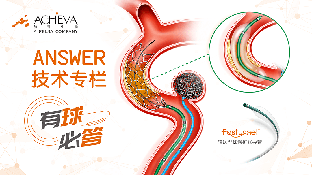 stenosis treatment using fastunnel delivering balloon dilatation