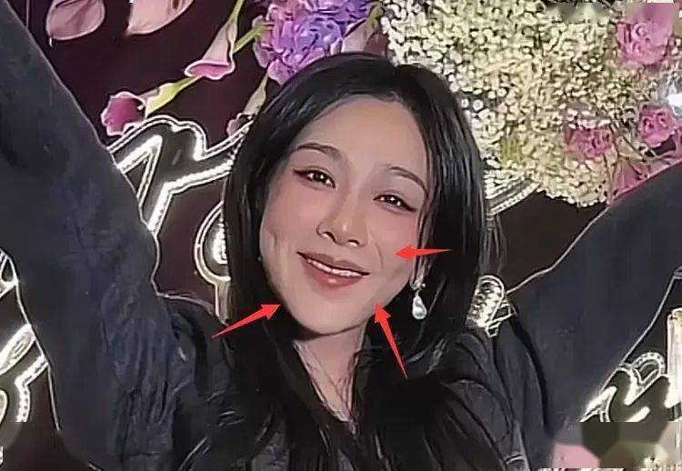 杨紫庆生照曝光,面部变化引热议,疑似整容传闻再起