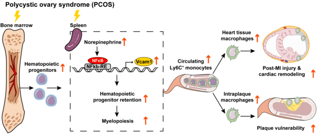 心血管疾病风险"的假说,创新性地发现pcos通过促进脾脏单核细胞生成