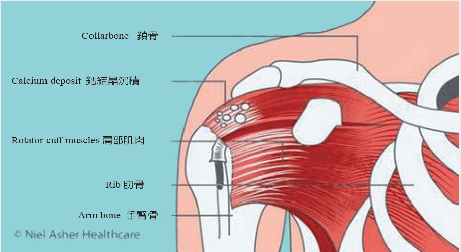 肩关节屈曲的肌肉图片