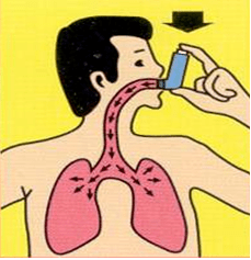 得了慢阻肺,该怎么办?戒烟是首要_治疗_康复_锻炼