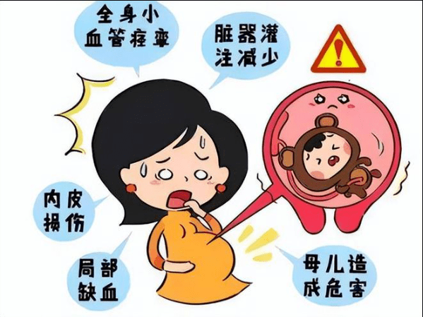 子痫前期到底是什么？_进行_妇幼保健院_母体