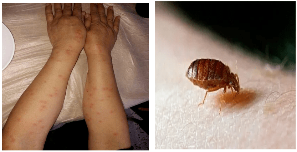 "臭虫"再度活跃不用慌,正确处理是关键_缝隙_进行_社会活动