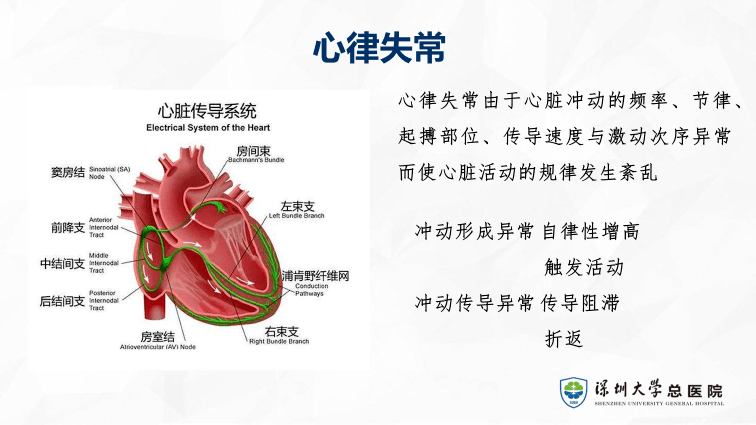 急救|快速性心律失常的應急處理_mg_藥物_治療