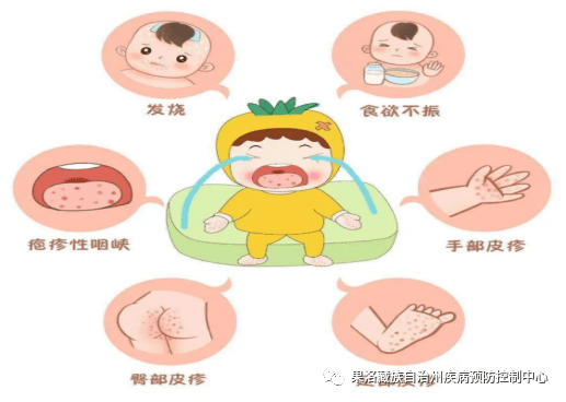 预防水痘卡通画图片