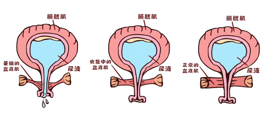 健康科普 产后 不可忽视的盆底肌损伤