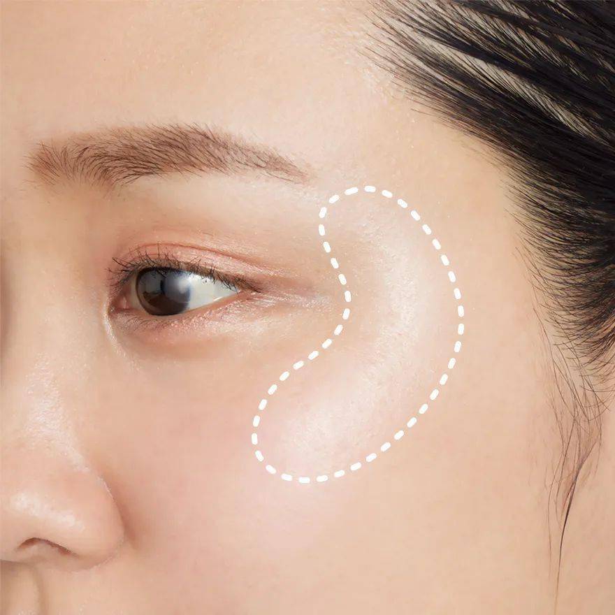 想要有提拉膨润感,整个脸周的线条紧实感就很重要,建议在眼尾延伸的