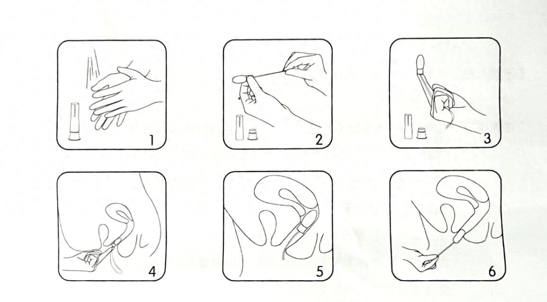 克霉唑栓使用方法图片