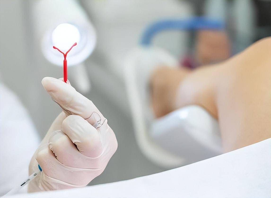 因计划生育带上节育环的女性,大多已经退休绝经,现在怎么样了_因为