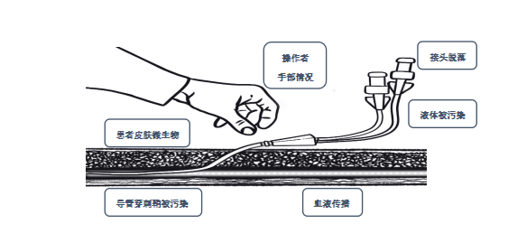 肝素帽留置针封管图片