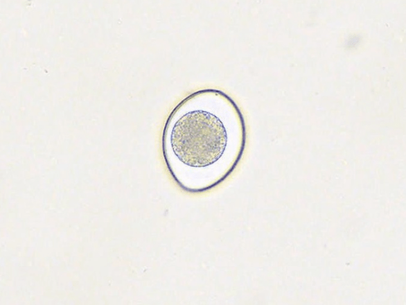 《中國伴侶動物寄生蟲地圖-獸醫快訊》-球蟲_驅蟲_病例_糞便