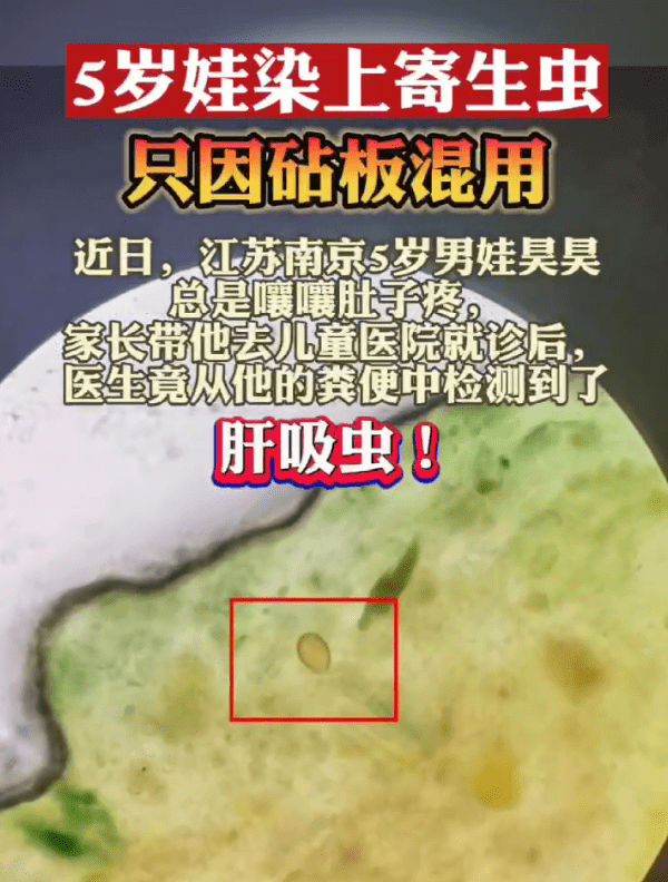 肝吸虫_症状_寄生虫