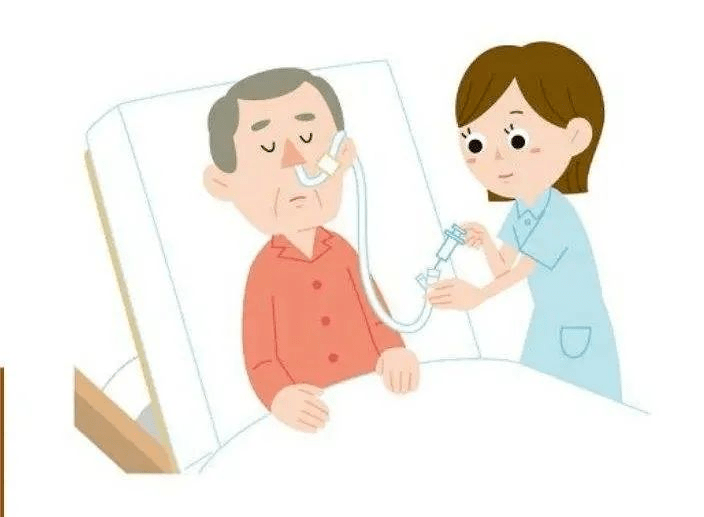 【医学科普】长期卧床鼻饲的目的及适用人群_患者_进行_营养